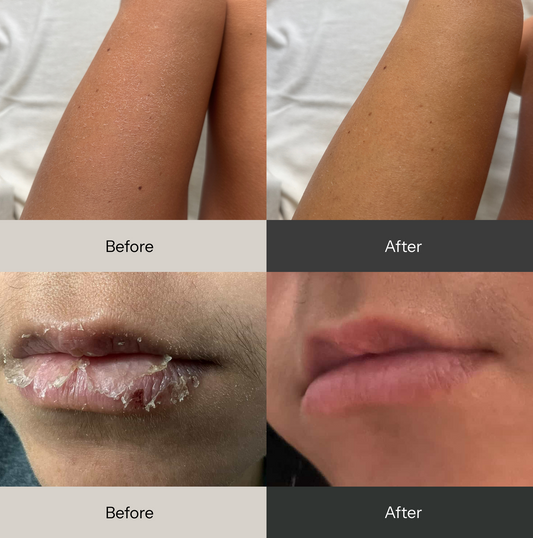 Universal - Multi-Purpose Balm - 50g